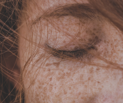 Can We Restore Our Skin Microbiome - and Should We ? | Learn with theSkinBiotic®